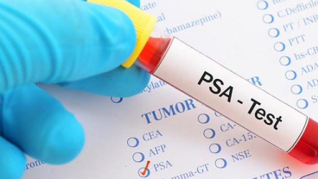 Tumore alla prostata e test Psa