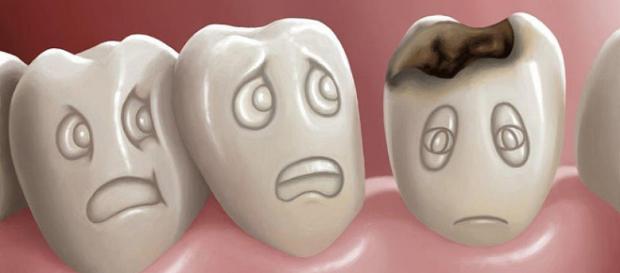 Caries Dental - alzamoradental.com Caries Dental - alzamoradental.com