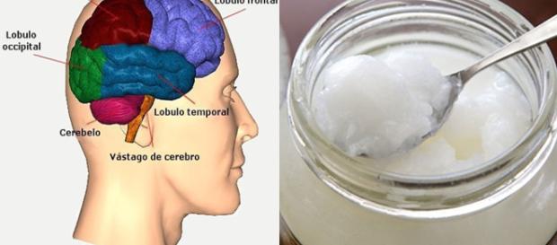 Alzheimer: ¿perdida de la memoria o demencia? Alzheimer: ¿perdida de la memoria o demencia?