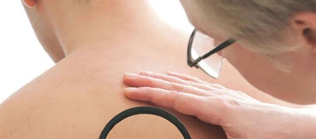 Mejores 259 imágenes de Eczema Living en Pinterest | Consejos pinterest.es Mejores 259 imágenes de Eczema Living en Pinterest | Consejos pinterest.es