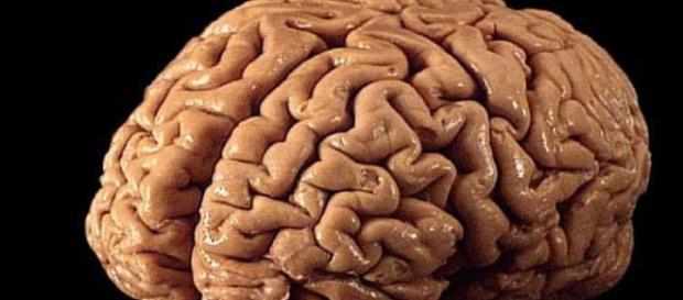El método, que se basó en imágenes de resonancia magnética del cerebro, examinó la correlación entre la cantidad de plegamientos El método, que se basó en imágenes de resonancia magnética del cerebro, examinó la correlación entre la cantidad de plegamientos