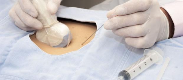 La Amniocentesis – Una decisión personal | Maternidadfacil - maternidadfacil.com La Amniocentesis – Una decisión personal | Maternidadfacil - maternidadfacil.com