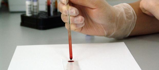 ONG's invitan a realizarse la prueba del VIH para acabar con la epidemia ONG's invitan a realizarse la prueba del VIH para acabar con la epidemia