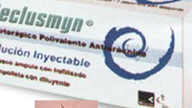 Dal Messico un siero contro i morsi del ragno violino