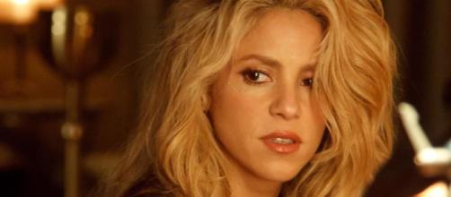 El método de Shakira para esconder su alopecia
