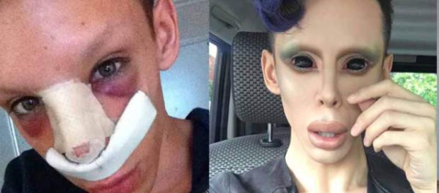 Joven se realizó 110 cirugías para lucir como un extraterrestre .ecuavisa.com Joven se realizó 110 cirugías para lucir como un extraterrestre .ecuavisa.com