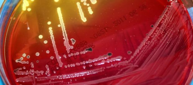Crean método de detección rápida de salmonella | EL DEBATE - com.mx Crean método de detección rápida de salmonella | EL DEBATE - com.mx