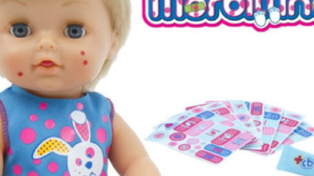 Ciccio bello con il morbillo: la bufera sui social, ecco perch&egrave;