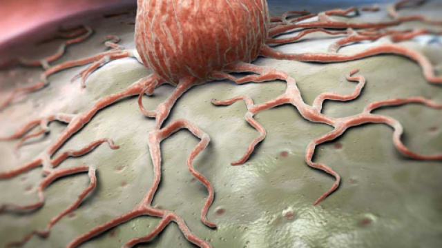 diabete di tipo 1 &egrave; legato al rischio di una vasta gamma di tumori ... - pazienti.it