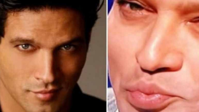 Gabriel Garko: “Ma quale rifatto, stavo male”. E minaccia querele ... - oggi.it