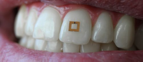 Sensor en los dientes para monitorizar tu alimentación Foto: Tufts Now