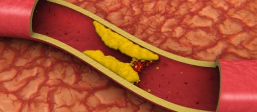 Un alimento se consumato tutti i giorni previene ictus e infarto