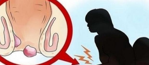Conheça os sintomas do vaginismo Conheça os sintomas do vaginismo
