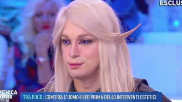 Luis Padron, diventato grazie alla chirurgia un uomo elfo, ospite a 'Domenica Live'.
