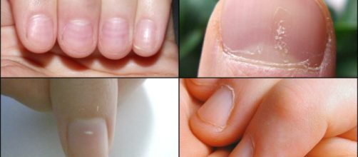 Así como la piel, las uñas también ofrecen signos que deben ser tenidos en cuenta para saber cómo anda su salud