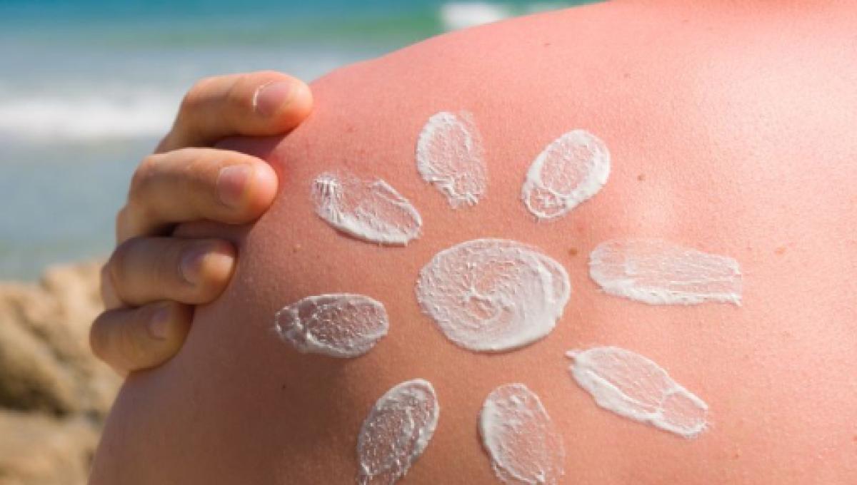 Compresas de agua fria para quemaduras de sol Compresas de agua fria para quemaduras de sol