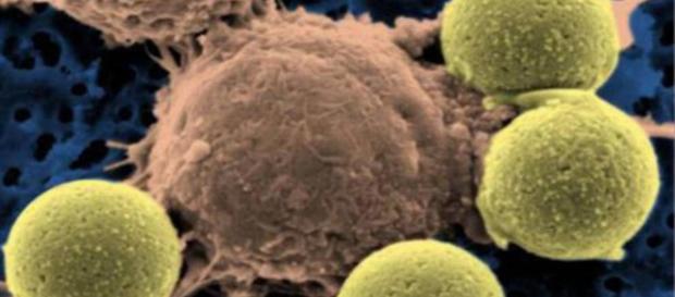 Mortalidad: Un nuevo tratamiento contra el cáncer logra evitar la elconfidencial.com Mortalidad: Un nuevo tratamiento contra el cáncer logra evitar la elconfidencial.com