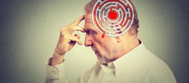 Salud: La primera señal del alzhéimer, descubierta por la ciencia elconfidencial.com Salud: La primera señal del alzhéimer, descubierta por la ciencia elconfidencial.com