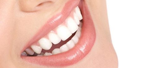 Trucos para limpiar los dientes - 4 pasos (con imágenes) - uncomo.com