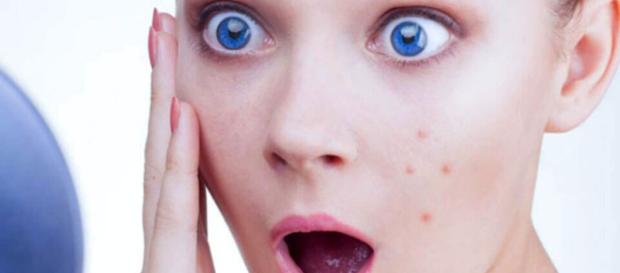 7 remedios caseros para las infecciones por hongos en hombres - vidasaludablesiete.com 7 remedios caseros para las infecciones por hongos en hombres - vidasaludablesiete.com