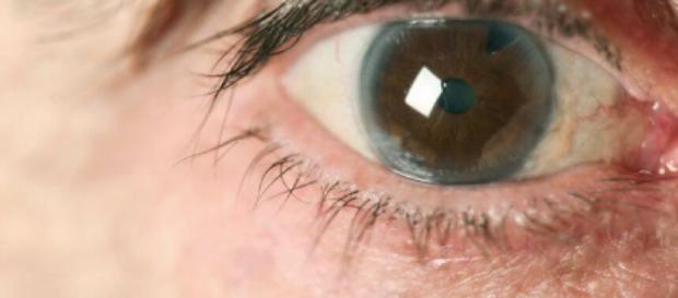Cómo prevenir el glaucoma de manera natural - Mejor con Salud - mejorconsalud.com Cómo prevenir el glaucoma de manera natural - Mejor con Salud - mejorconsalud.com