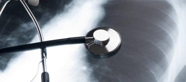 Salud: Cuidado, estos son los primeros síntomas del cáncer de pulmón Salud: Cuidado, estos son los primeros síntomas del cáncer de pulmón