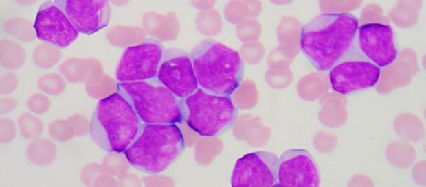 Un análisis de sangre es una herramienta crucial para el médico que el paciente muy pocas veces puede comprender Un análisis de sangre es una herramienta crucial para el médico que el paciente muy pocas veces puede comprender