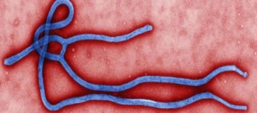 El virus del Ébola ocasiona una enfermedad hemorrágica mortal