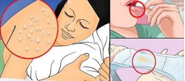 Imagens usada apenas para fins ilustrativos Imagens usada apenas para fins ilustrativos