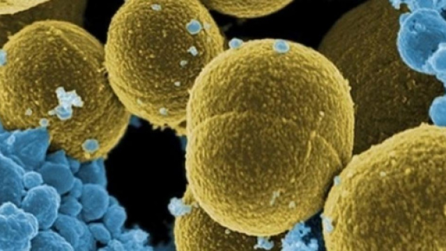 Scienza: Germania scopre farmaco antibiotico umano per combattere influenza - blastingnews.com