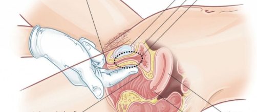 Vagina examination urethral opening vaginal wall anal opening ... - anatomynote.com
