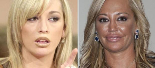 Estas son las famosas españolas con más operaciones de estética! - blastingnews.com Estas son las famosas españolas con más operaciones de estética! - blastingnews.com