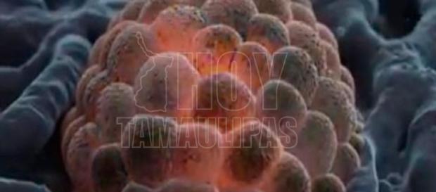 Hoy Tamaulipas - Mieloma multiple cancer que debilita huesos pero ... - hoytamaulipas.net Hoy Tamaulipas - Mieloma multiple cancer que debilita huesos pero ... - hoytamaulipas.net