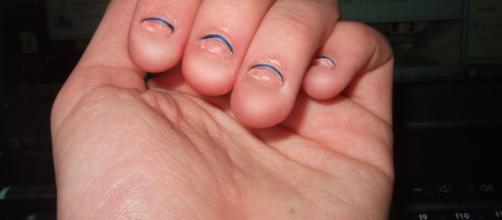 absolutely short bitten nails | my_season | Flickr - flickr.com