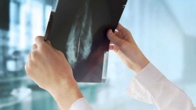 Centinaia di donne sarebbero morte di cancro per colpa di un errore del pc