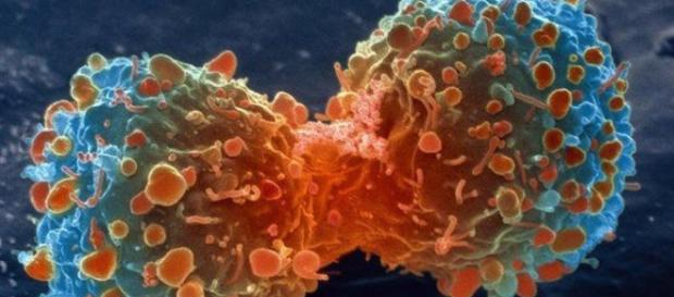 Autofagia y cáncer, un fragmento del libro Cáncer Integral de ... - sott.net Autofagia y cáncer, un fragmento del libro Cáncer Integral de ... - sott.net