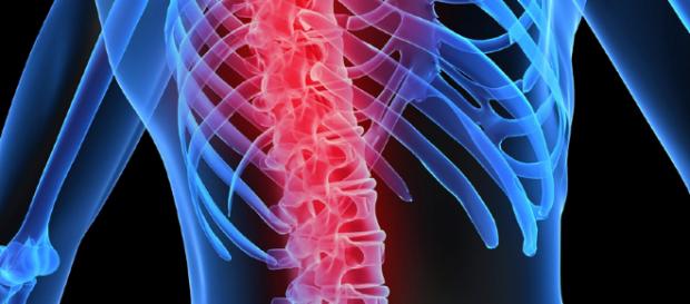 Osteoporosis en hombres prevención y tratamiento | Neolife - neolifeclinic.com Osteoporosis en hombres prevención y tratamiento | Neolife - neolifeclinic.com