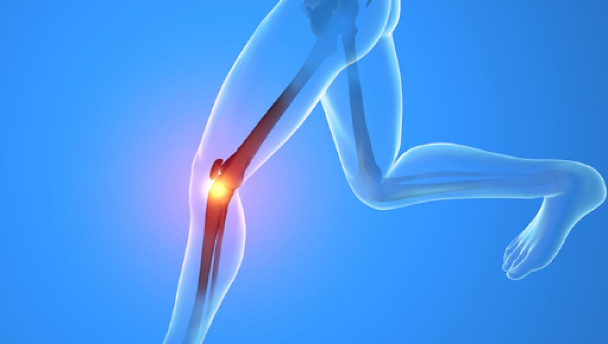 Dolor en la rodilla solo al subir escaleras