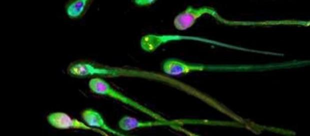 Los hombres tienen cada vez menos espermatozoides - clarin.com Los hombres tienen cada vez menos espermatozoides - clarin.com