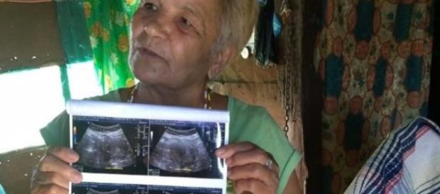 Mujer de 70 años podría estar embarazada Mujer de 70 años podría estar embarazada