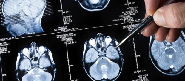Salud: Por qué los medicamentos contra el alzhéimer pueden hacer ... - elconfidencial.com Salud: Por qué los medicamentos contra el alzhéimer pueden hacer ... - elconfidencial.com