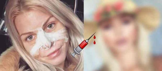 Jessica Thivenin a-t-elle subi des injections dans les lèvres ? La photo qui sème le doute ! Jessica Thivenin a-t-elle subi des injections dans les lèvres ? La photo qui sème le doute !