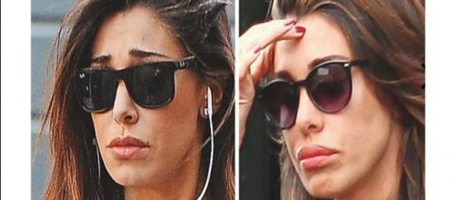 Gossip: ennesimo ritocchino estetico per Belen Rodriguez? Le foto sospette.