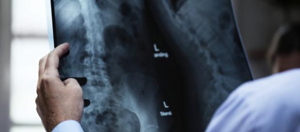 Cáncer de huesos. Conoce como identificarlo a tiempo. Colapep. - colapep.com Cáncer de huesos. Conoce como identificarlo a tiempo. Colapep. - colapep.com