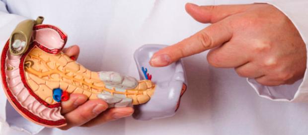 Cáncer de Páncreas | Dr Isidoro Wiener Carrillo Gastrocirujano - gastroenterologos.net Cáncer de Páncreas | Dr Isidoro Wiener Carrillo Gastrocirujano - gastroenterologos.net