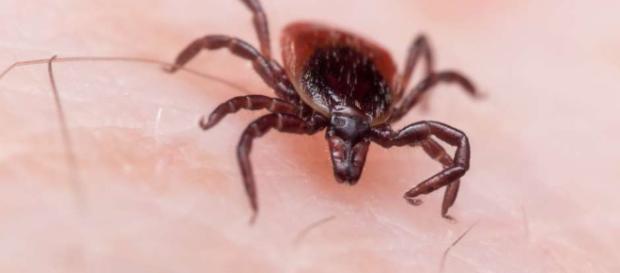 Lo que necesitas saber sobre la enfermedad de Lyme | La Opinión - laopinion.com Lo que necesitas saber sobre la enfermedad de Lyme | La Opinión - laopinion.com