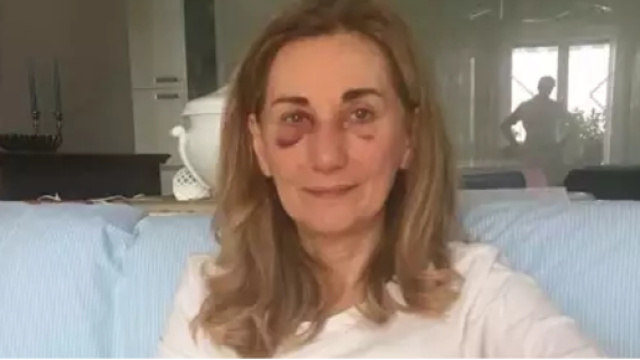 La professoressa vittima della vicenda - LaPresse