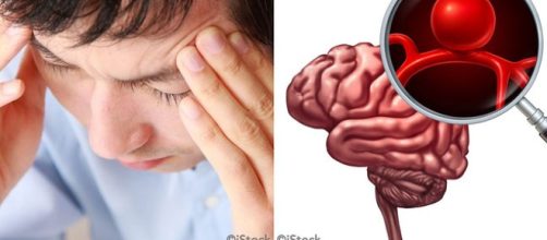 Síntomas de un Aneurisma cerebral y factores de riesgo a tomar en cuenta