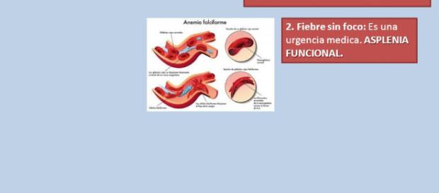 ANEMIA DREPANOCITICA. ¿SOLO HOSPITALARIA? - ppt descargar - slideplayer.es ANEMIA DREPANOCITICA. ¿SOLO HOSPITALARIA? - ppt descargar - slideplayer.es