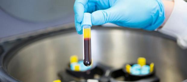 análisis de sangre allana la vía al diagnostico precoz del alzheimer - lavanguardia.com análisis de sangre allana la vía al diagnostico precoz del alzheimer - lavanguardia.com